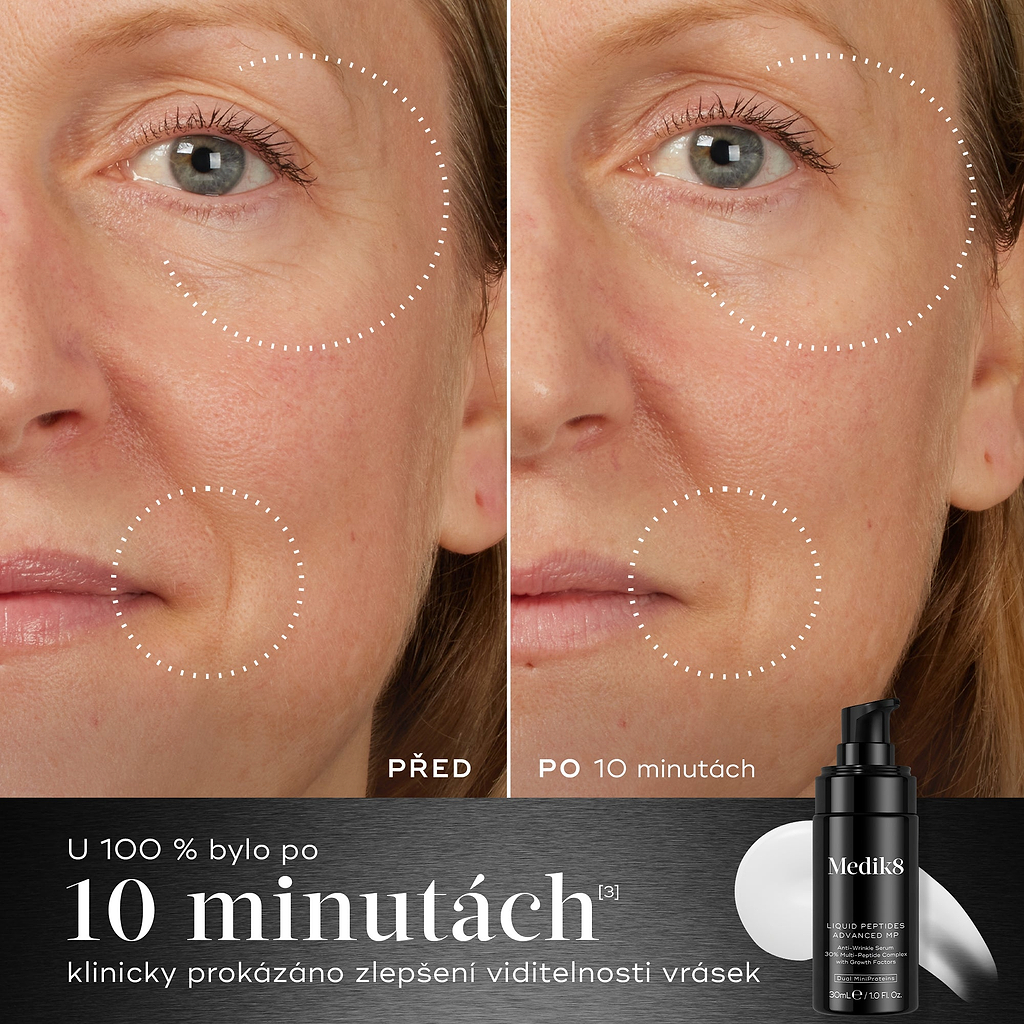 10 minuty – Srovnání „před a po“ obličeje účastníka zobrazené vedle lahvičky Medik8 Liquid Peptides Advanced MP ukazuje snížení vrásek v oblasti očí a úst. Text zdůrazňuje, že 100 % účastníků vykázalo klinické zlepšení viditelných vrásek během 10 minut.