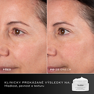 28 dní – Porovnání obličeje účastnice před a po 28 dnech vedle balení krému Medik8 Advanced Pro-Collagen+ Peptide Cream. Text zdůrazňuje klinicky prokázané výsledky v oblasti hladkosti, pevnosti a struktury pleti.