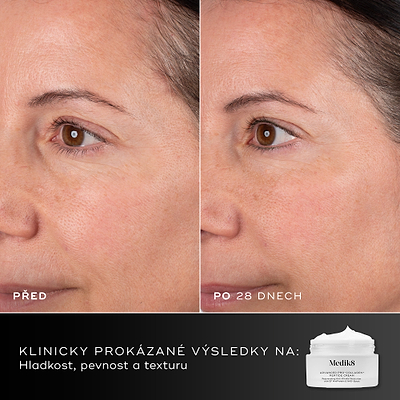 28 dní – Porovnání obličeje účastnice před a po 28 dnech vedle balení krému Medik8 Advanced Pro-Collagen+ Peptide Cream. Text zdůrazňuje klinicky prokázané výsledky v oblasti hladkosti, pevnosti a struktury pleti.