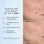 Detailní snímky tváře „Před“ a „Po 4 týdnech“ vedle sebe zobrazují pleť se zarudnutím a nerovnoměrnou texturou.
Text pod obrázkem uvádí:
„Klinicky prokázáno, že viditelně redukuje zarudnutí a zlepšuje zdraví kožní bariéry.“*