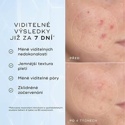 Detailní snímky tváře „Před“ a „Po 4 týdnech“ vedle sebe zobrazují pleť se zarudnutím a nerovnoměrnou texturou.
Text pod obrázkem uvádí:
„Klinicky prokázáno, že viditelně redukuje zarudnutí a zlepšuje zdraví kožní bariéry.“*