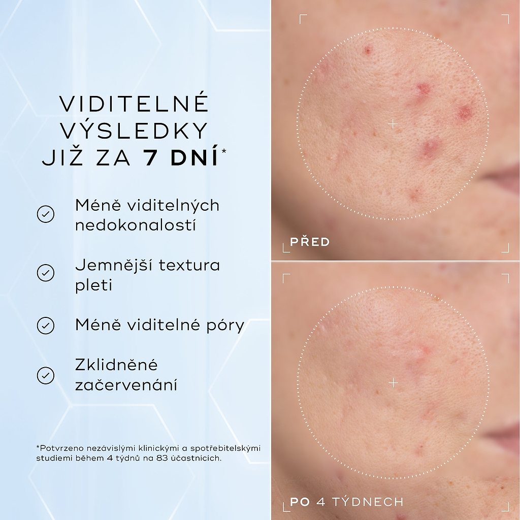 Detailní snímky tváře „Před“ a „Po 4 týdnech“ vedle sebe zobrazují pleť se zarudnutím a nerovnoměrnou texturou.
Text pod obrázkem uvádí:
„Klinicky prokázáno, že viditelně redukuje zarudnutí a zlepšuje zdraví kožní bariéry.“*