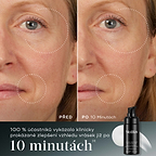 Porovnání účinků před a po 10 minutách. 100 % účastníků vykázalo klinicky prokázané zlepšení vzhledu vrásek již po 10 minutách.