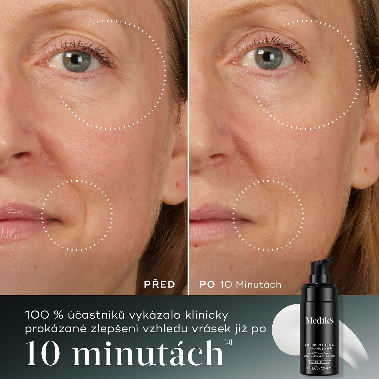 Porovnání účinků před a po 10 minutách. 100 % účastníků vykázalo klinicky prokázané zlepšení vzhledu vrásek již po 10 minutách.