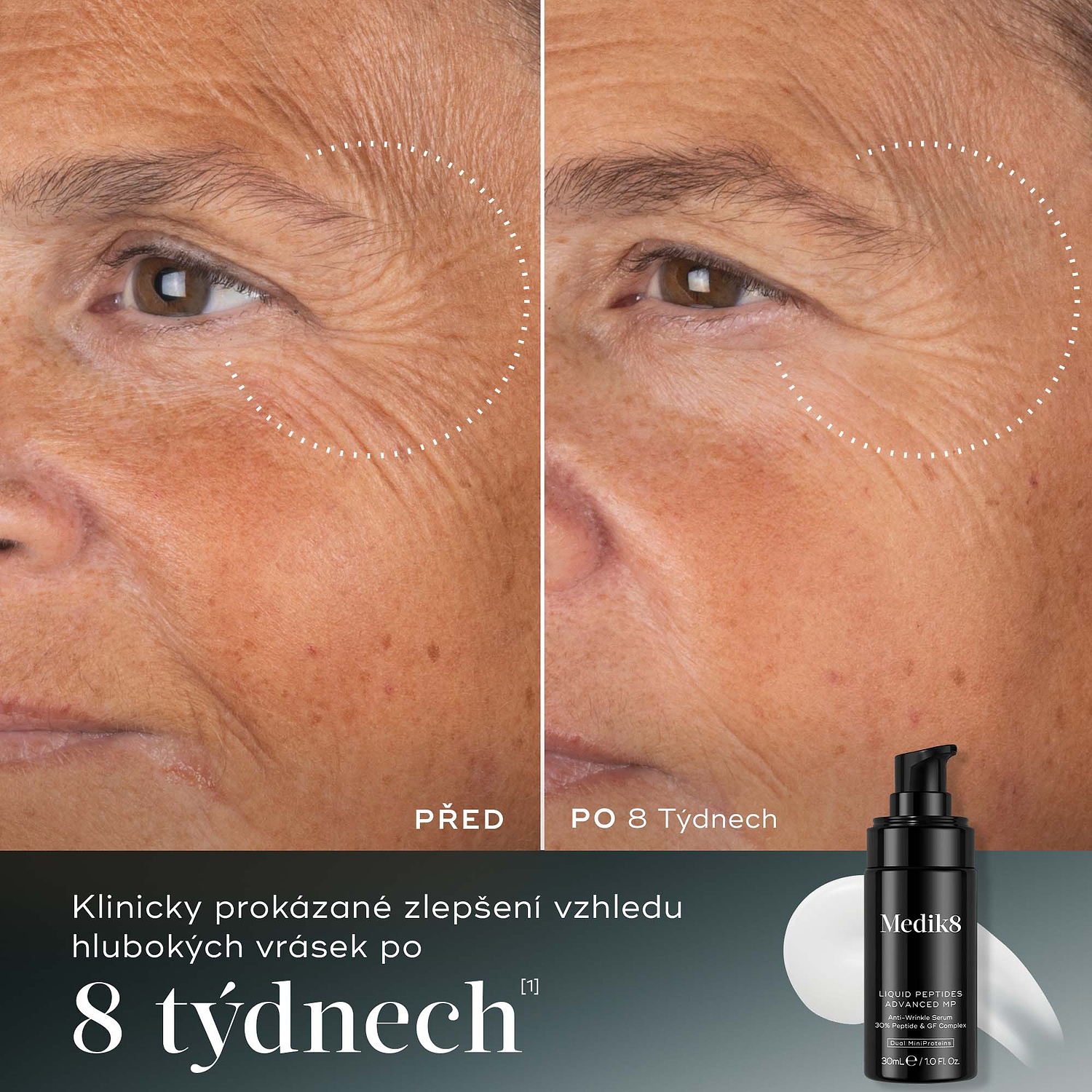 Porovnání účinků před a po 8 týdnech užívání: Klinicky prokázané zlepšení vzhledu hlubokých vrásek po 8 týdnech.