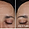 Crystal Retinal®