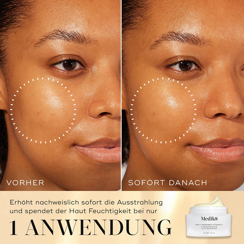 Vorher-nachher-Vergleich des Gesichts eines Models, der die Ergebnisse von Daily Radiance Vitamin C zeigt. Weiße, gepunktete Kreise heben einen bestimmten Bereich der Wange hervor, um eine sichtbare Steigerung von Strahlkraft und Feuchtigkeit direkt nach einer Anwendung zu zeigen.