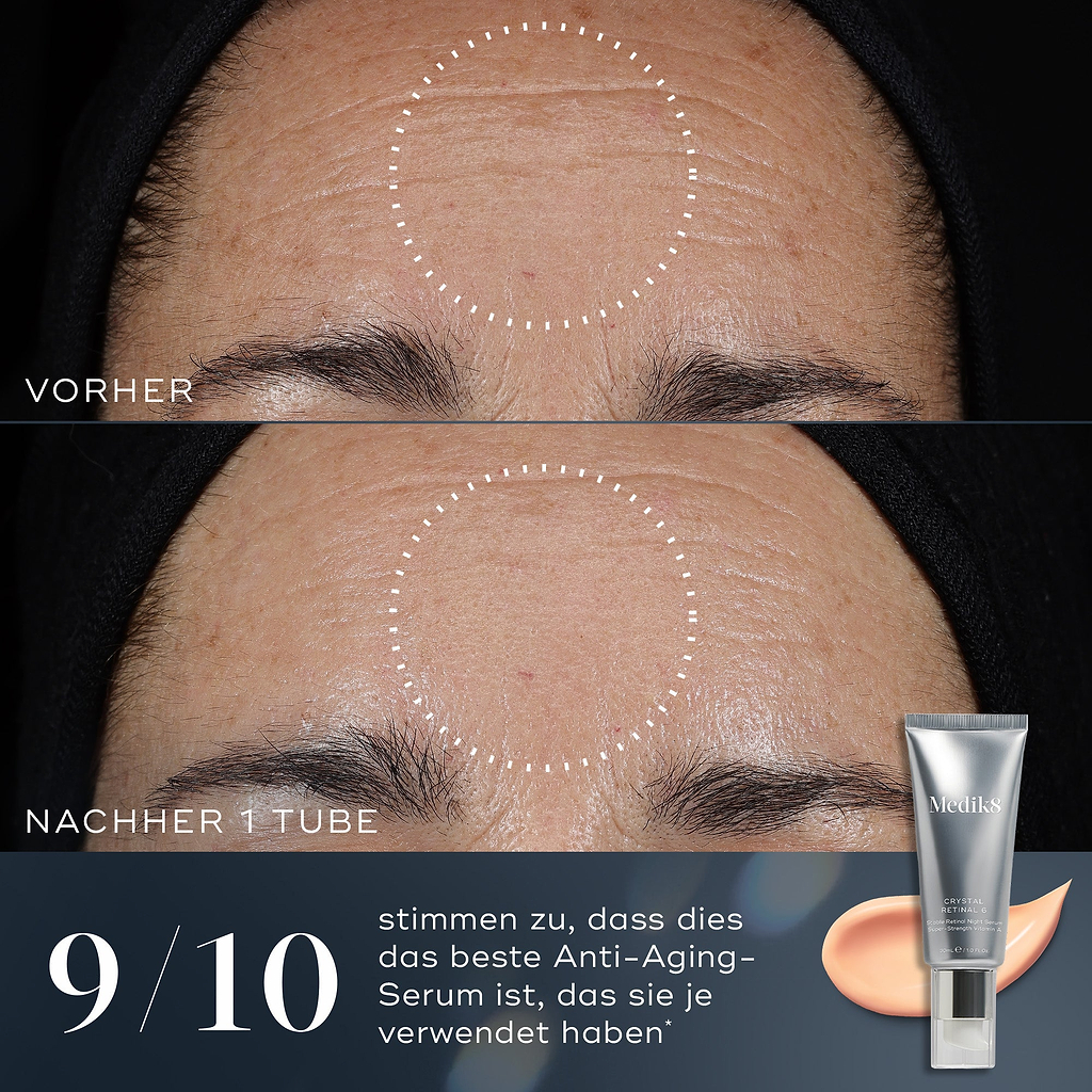  Image avant et après d'un front montrant une réduction des rides après l'utilisation de Medik8 Crystal Retinal. 