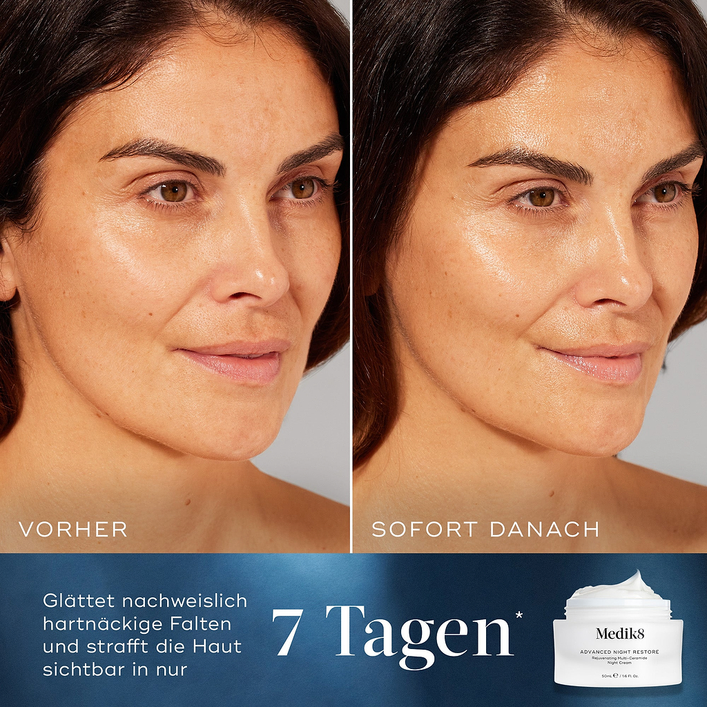 Nebeneinander Vergleich des Gesichts einer Frau, gekennzeichnet als Vorher und Sofort Danach, mit sichtbar gesteigerter Ausstrahlung und Feuchtigkeit. Der Text unten lautet Nachweislich glättet es hartnäckige Falten und hebt die Haut sichtbar in nur 7 Tagen.