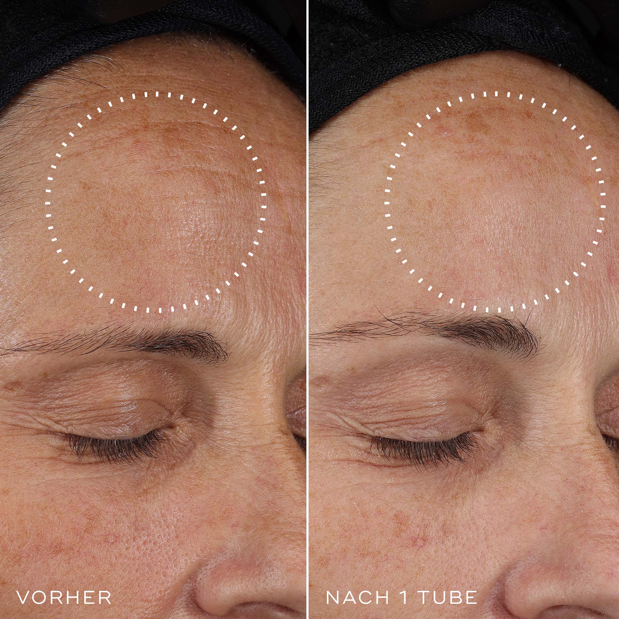 Crystal Retinal - Discover More – Medik8-DE