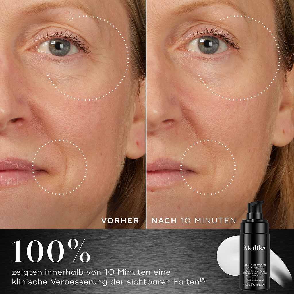 Ein Vorher-Nachher-Vergleich des Gesichts eines Teilnehmers wird neben der Flasche des Medik8 Liquid Peptides Advanced MP gezeigt. Die Bilder demonstrieren eine Verringerung der Falten um Augen und Mund. Der Text hebt hervor, dass 100 % eine klinische Verbesserung sichtbarer Falten innerhalb von 10 Minuten zeigten.