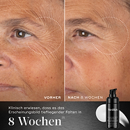 Ein Vorher-Nachher-Vergleich über 8 Wochen zeigt den Augen- und Wangenbereich einer Person und veranschaulicht die Verringerung des Erscheinungsbilds tiefsitzender Falten. Unter den Bildern heißt es: Klinisch erwiesen, das Erscheinungsbild tiefsitzender Falten innerhalb von 8 Wochen zu verbessern.