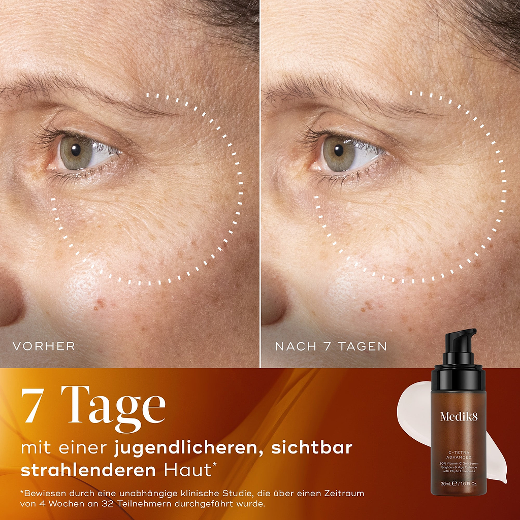 Bild 2: Vorher-Nachher-Vergleich der Haut eines Teilnehmers über 7 Tage, zeigt sichtbar strahlendere Haut mit verbessertem Teint und gleichmäßiger Farbgebung.
