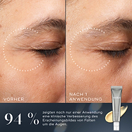 Ein Vorher-Nachher-Vergleich des Augenbereichs einer Person zeigt eine Verbesserung des Erscheinungsbilds von Falten um die Augen nach nur einer Anwendung. Unter den Bildern heißt es, dass 94 % eine klinische Verbesserung des Faltenbildes um die Augen nach nur einer Anwendung zeigten.