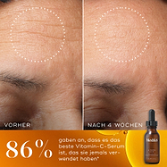 Ein „Vorher-Nachher“-Vergleich der Stirn einer Person über 4 Wochen. Das „Vorher“-Bild zeigt sichtbare Stirnfalten, während das „Nachher“-Bild eine deutlich glattere Haut zeigt. Ein großer Text besagt, dass 86 % zustimmten, dass es das beste Vitamin-C-Serum ist, das sie je verwendet haben.