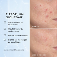 Geteiltes Bild mit der Schaumanwendung neben einer Liste von Vorteilen, einschließlich Entfernt Make-up, Sonnenschutz & Unreinheiten und Reinigt & Nährt die Haut.