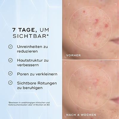 Geteiltes Bild mit der Schaumanwendung neben einer Liste von Vorteilen, einschließlich Entfernt Make-up, Sonnenschutz & Unreinheiten und Reinigt & Nährt die Haut.