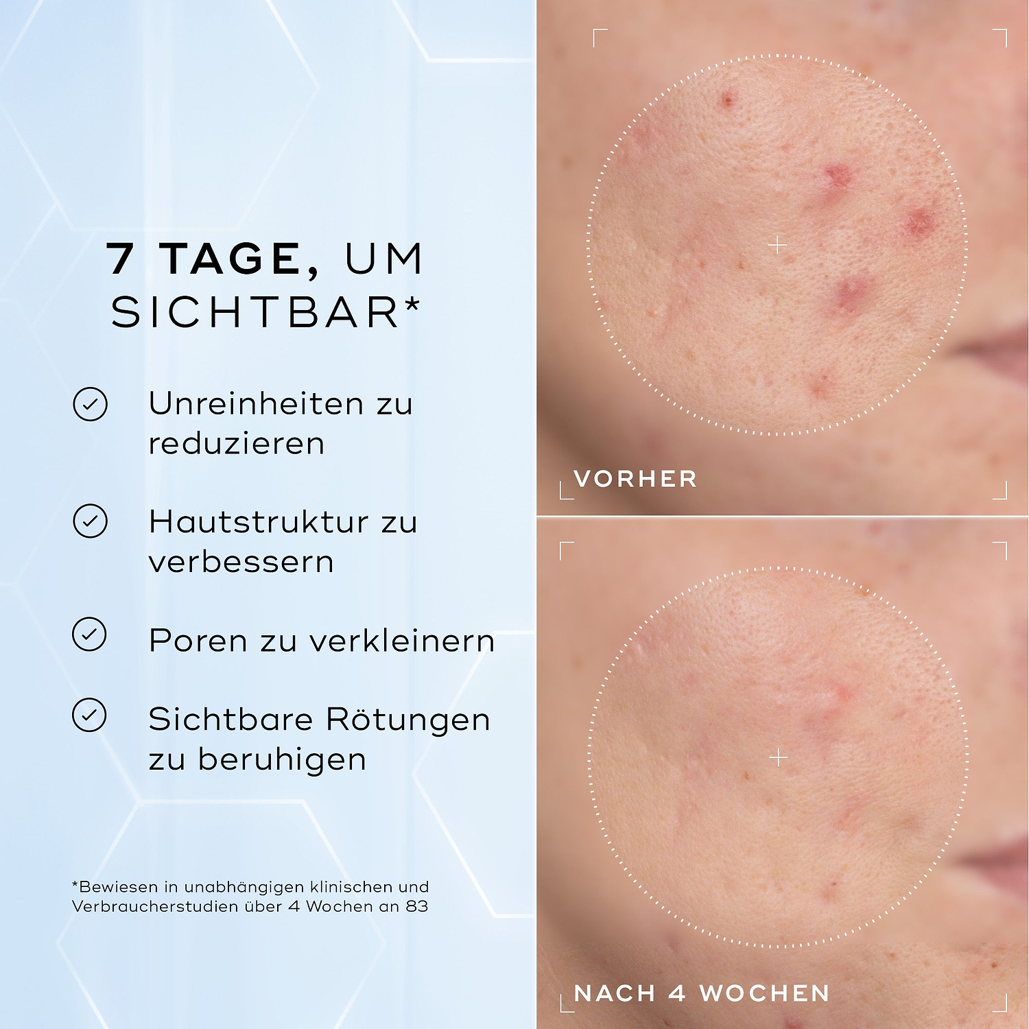 Geteiltes Bild mit der Schaumanwendung neben einer Liste von Vorteilen, einschließlich Entfernt Make-up, Sonnenschutz & Unreinheiten und Reinigt & Nährt die Haut.