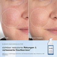 Nebeneinander angeordnete Nahaufnahmen einer Wange mit Rötungen und ungleichmäßiger Textur, gekennzeichnet als Vorher und Nach 4 Wochen. Der Text darunter lautet Klinisch erwiesen, dass sichtbare Rötungen reduziert und die Hautbarrieregesundheit verbessert werden.