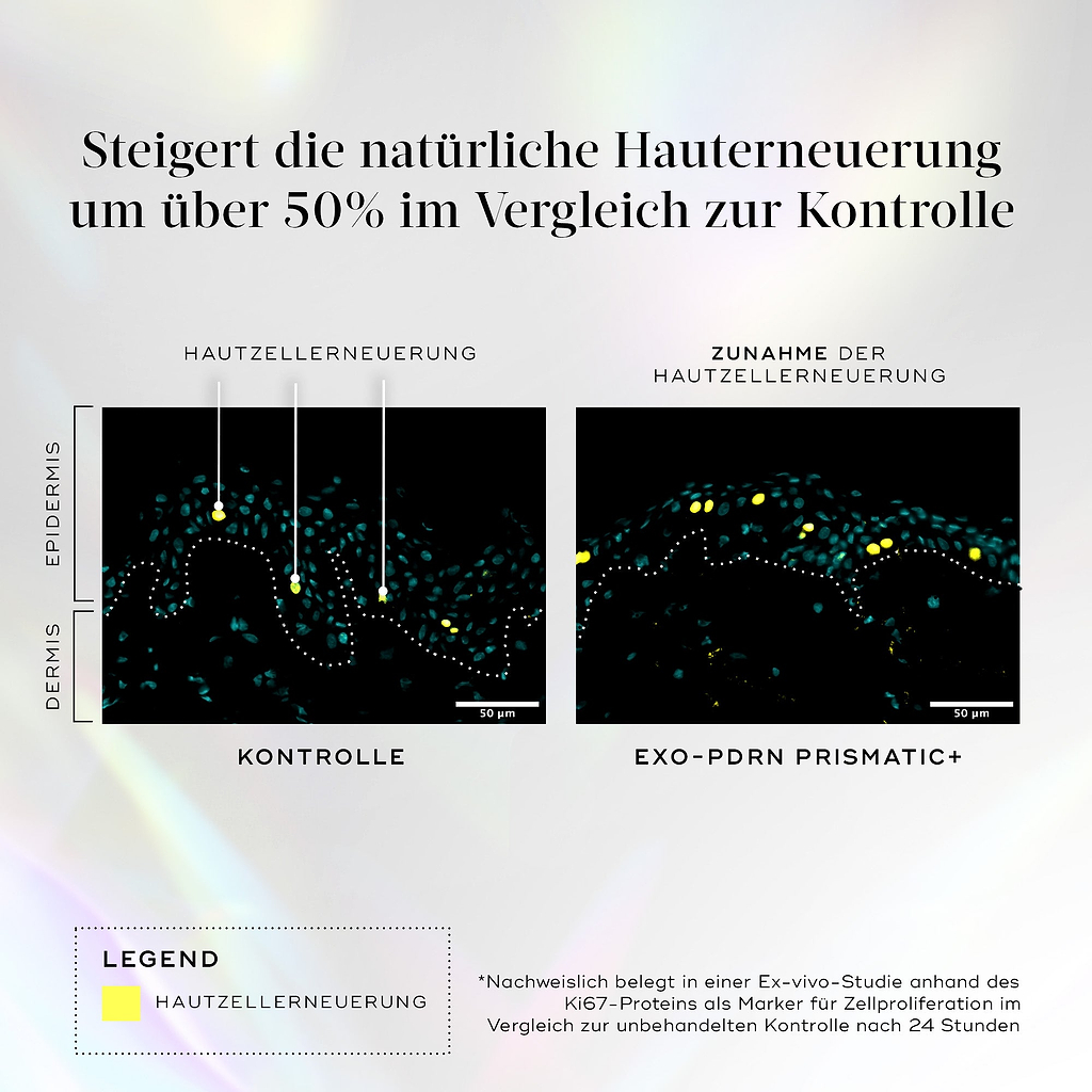 Infografik auf hellem, holografischem Hintergrund mit dem Titel „Steigert die natürliche Hauterneuerung um über 50 % im Vergleich zur Kontrolle“. Zwei mikroskopische Hautquerschnitte vergleichen „Kontrolle“ und „Exo-PDRN Prismatic+“. Die Exo-PDRN-Seite zeigt eine sichtbare Zunahme gelber Punkte, in der Legende als „Hautzellregeneration“ bezeichnet. Der Text weist darauf hin, dass dies in einer Ex-vivo-Studie anhand des Ki67-Proteinmarkers im Vergleich zur unbehandelten Kontrolle nach 24 Stunden nachgewiesen