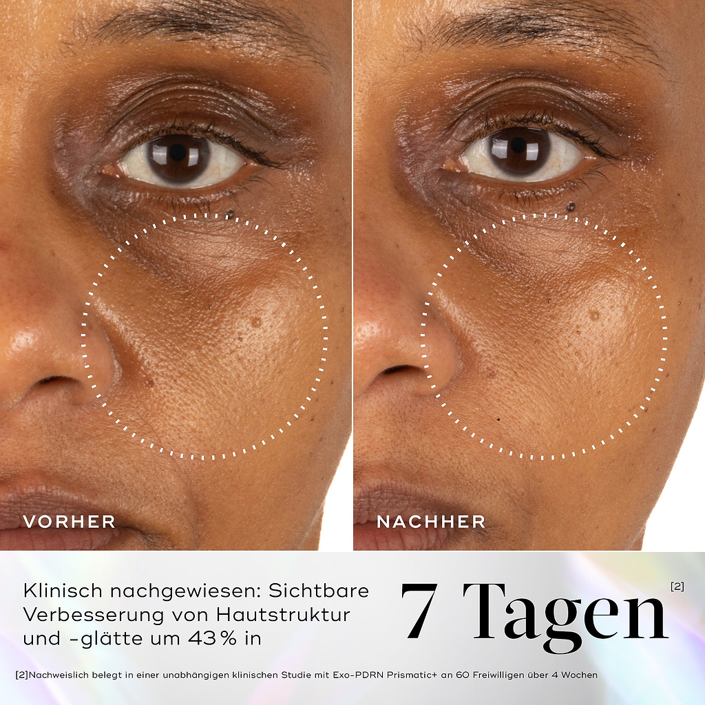 Vorher-Nachher-Nahaufnahme der Wangenpartie einer Testperson mit gestrichelten Kreisen, die sichtbar glattere Hautstruktur hervorheben. Der Text darunter auf holografischem Hintergrund lautet: „Klinisch nachgewiesen: Verbessert Hautstruktur & Glätte sichtbar um 43 % in 7 Tagen.“ Eine Fußnote bestätigt, dass dies in einer unabhängigen klinischen Studie zu Exo-PDRN Prismatic+ mit 60 Probanden über 4 Wochen belegt wurde.