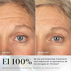 Comparación del antes y después de la frente y el área de los ojos de una persona, con un círculo punteado que resalta una reducción visible de las arrugas en la frente. Debajo, un texto grande indica que el 100% de los participantes notó una reducción visible de las arrugas en 14 días.