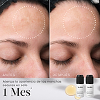 Comparación de antes y después de la frente de una persona que muestra una atenuación de las manchas oscuras. Círculos blancos punteados resaltan las áreas donde se observan los cambios. Debajo de las imágenes, el texto indica: «Atenúa la apariencia de las manchas oscuras en solo 1 mes».

