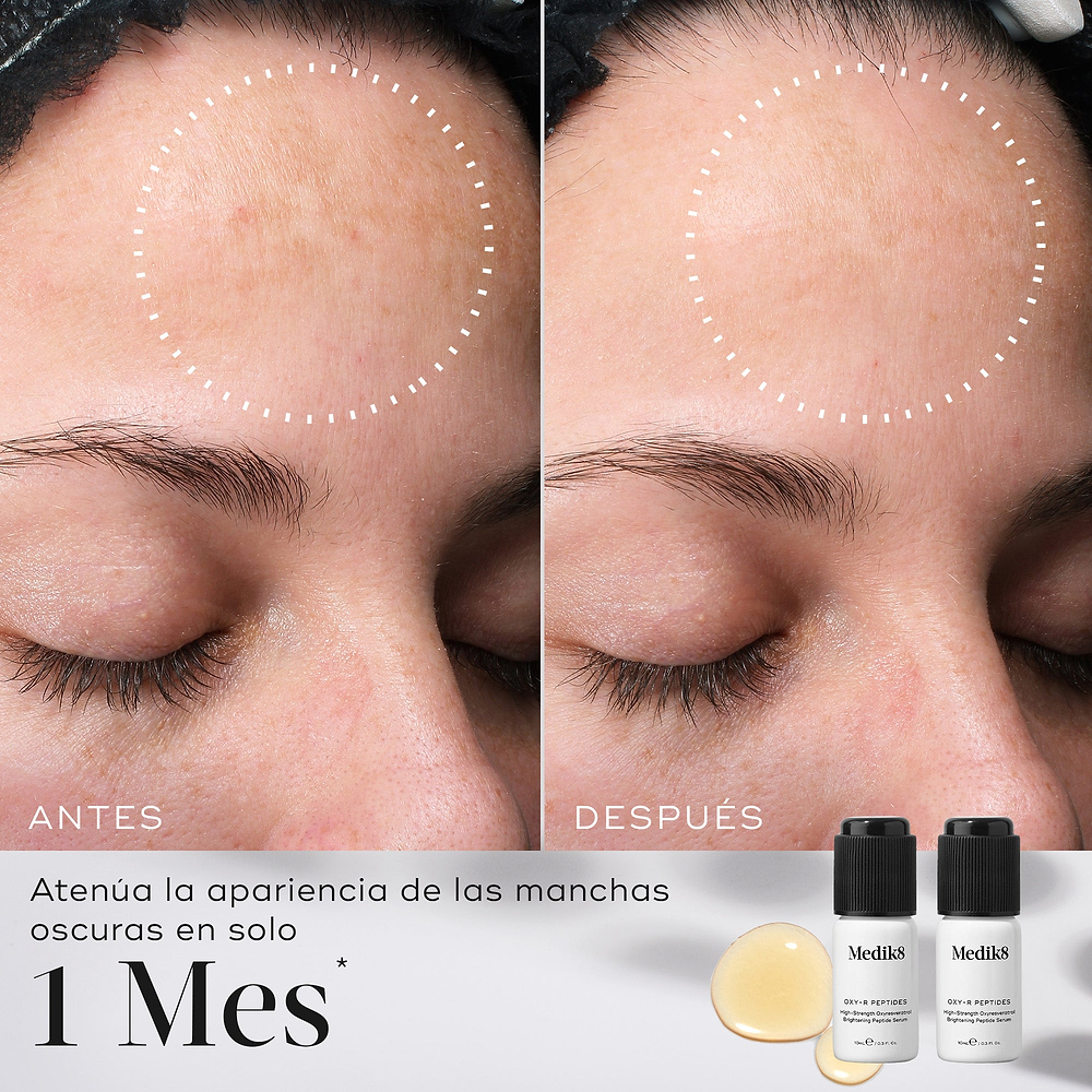 Comparación de antes y después de la frente de una persona que muestra una atenuación de las manchas oscuras. Círculos blancos punteados resaltan las áreas donde se observan los cambios. Debajo de las imágenes, el texto indica: «Atenúa la apariencia de las manchas oscuras en solo 1 mes».
