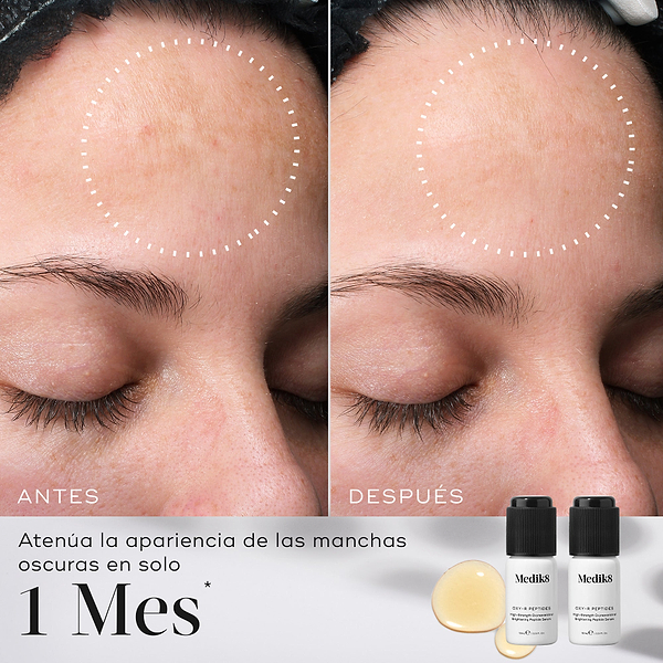 Comparación de antes y después de la frente de una persona que muestra una atenuación de las manchas oscuras. Círculos blancos punteados resaltan las áreas donde se observan los cambios. Debajo de las imágenes, el texto indica: «Atenúa la apariencia de las manchas oscuras en solo 1 mes».
