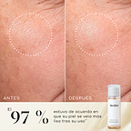 Primer plano de antes y después de la piel de la mejilla de un participante, mostrando una textura más suave y una apariencia más uniforme. La botella del tónico Medik8 Press & Glow aparece en una esquina. El texto destaca que el 97 % está de acuerdo en que su piel se veía más suave después de usarlo.