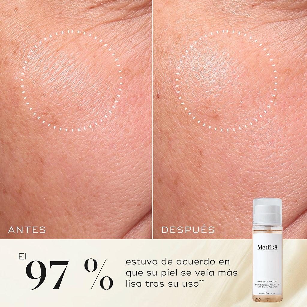 Primer plano de antes y después de la piel de la mejilla de un participante, mostrando una textura más suave y una apariencia más uniforme. La botella del tónico Medik8 Press & Glow aparece en una esquina. El texto destaca que el 97 % está de acuerdo en que su piel se veía más suave después de usarlo.
