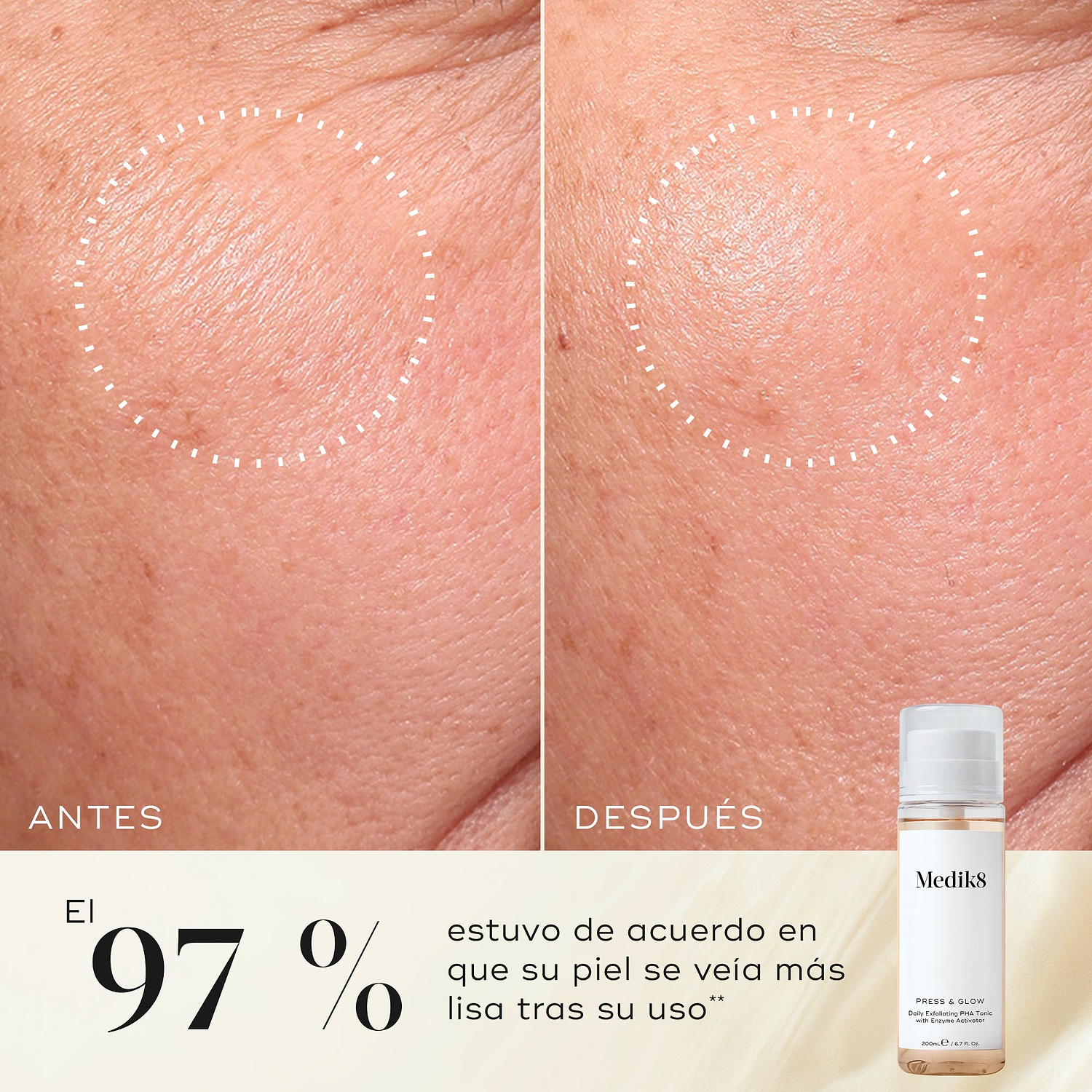 Primer plano de antes y después de la piel de la mejilla de un participante, mostrando una textura más suave y una apariencia más uniforme. La botella del tónico Medik8 Press & Glow aparece en una esquina. El texto destaca que el 97 % está de acuerdo en que su piel se veía más suave después de usarlo.