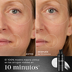 **10 min**: Comparación de antes y después del rostro de un participante mostrada junto a la botella de Medik8 Liquid Peptides Advanced MP. Las imágenes muestran una reducción de las arrugas alrededor de los ojos y la boca. El texto destaca que el **100 % mostró una mejora clínica en las arrugas visibles en 10 minutos**.
