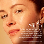 Para Reino Unido: Primer plano de una mujer con una tez luminosa y radiante apoyando la mano sobre la mejilla. El texto dice: “El 87 % de las pieles sensibles está de acuerdo en que este es el sérum de vitamina C más suave que han usado.” Un texto más pequeño debajo indica que los resultados se basan en un estudio de consumidores.