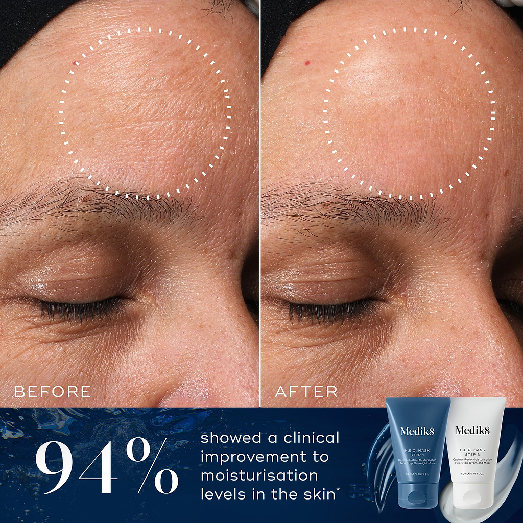 A before-and-after comparison of a woman's forehead shows improved moisturisation levels in the skin. Below the images, text states 94% of particpants agreed.