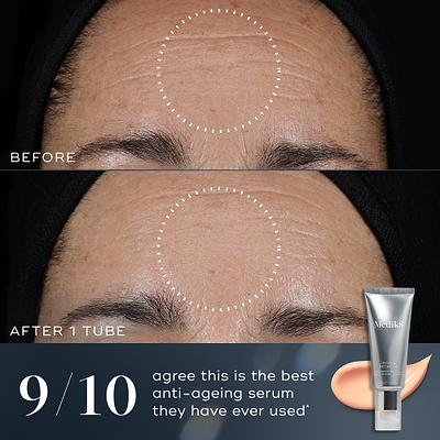 A before-and-after comparison of a person's forehead shows visible improvement in fine lines and wrinkles after one tube of Crystal Retinal. Text states 9/10 agree this is the best anti-ageing serum they have ever used.