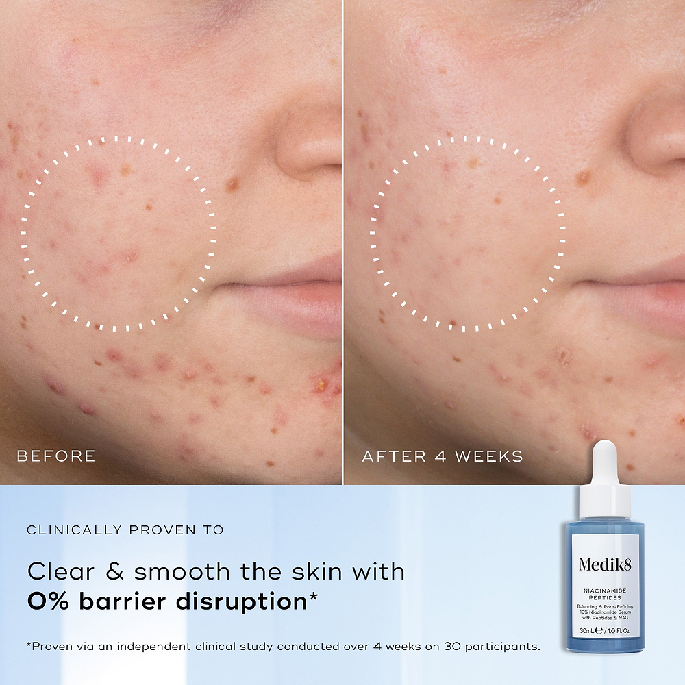 Before and after comparison of skin with a skincare product from Medik8.