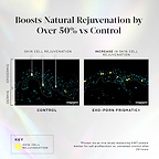A graphic titled ‘Boost Natural Rejuvenation by over 50% vs Control,’ showing two images comparison of the skin’s dermis and epidermis, pointing to skin cell rejuvenation and increased skin cell rejuvenation with Exo-PDRN Prismatic+. 

*Proven via ex vivo study measuring Ki67 protein marker foor cell proliferation vs. untreated control after 24 hours