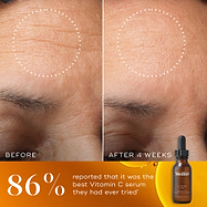 Before and after comparison of skin texture with a bottle of Medik8 serum.