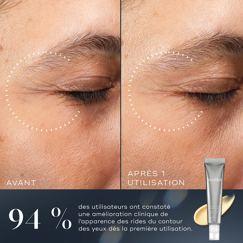 Une comparaison avant-après de la zone des yeux d’une personne montre une amélioration de l’apparence des rides autour des yeux après une seule utilisation. Sous les images, le texte indique que 94 % ont montré une amélioration clinique de l’apparence des rides autour des yeux après une seule utilisation.