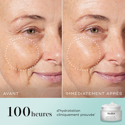 Comparaison en écran scindé avant-après de la joue et du contour des yeux d'une femme, avec un cercle pointillé soulignant la peau visiblement repulpée et les rides réduites sur la photo « IMMEDIATELY AFTER ». Le texte indique « 100 heures d'hydratation cliniquement prouvée* » à côté d'une image du pot Medik8 Total Moisture.