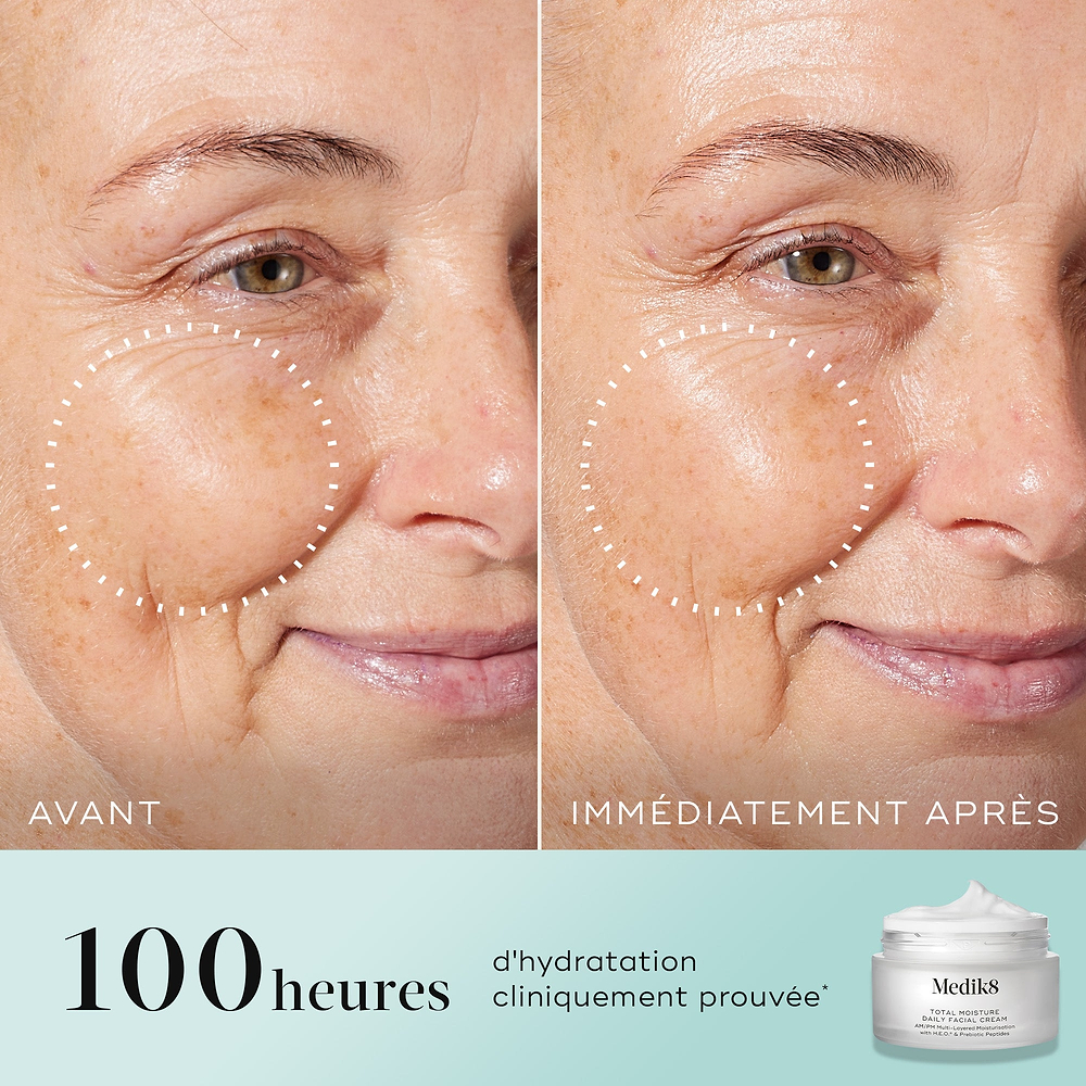 Comparaison en écran scindé avant-après de la joue et du contour des yeux d'une femme, avec un cercle pointillé soulignant la peau visiblement repulpée et les rides réduites sur la photo « IMMEDIATELY AFTER ». Le texte indique « 100 heures d'hydratation cliniquement prouvée* » à côté d'une image du pot Medik8 Total Moisture.