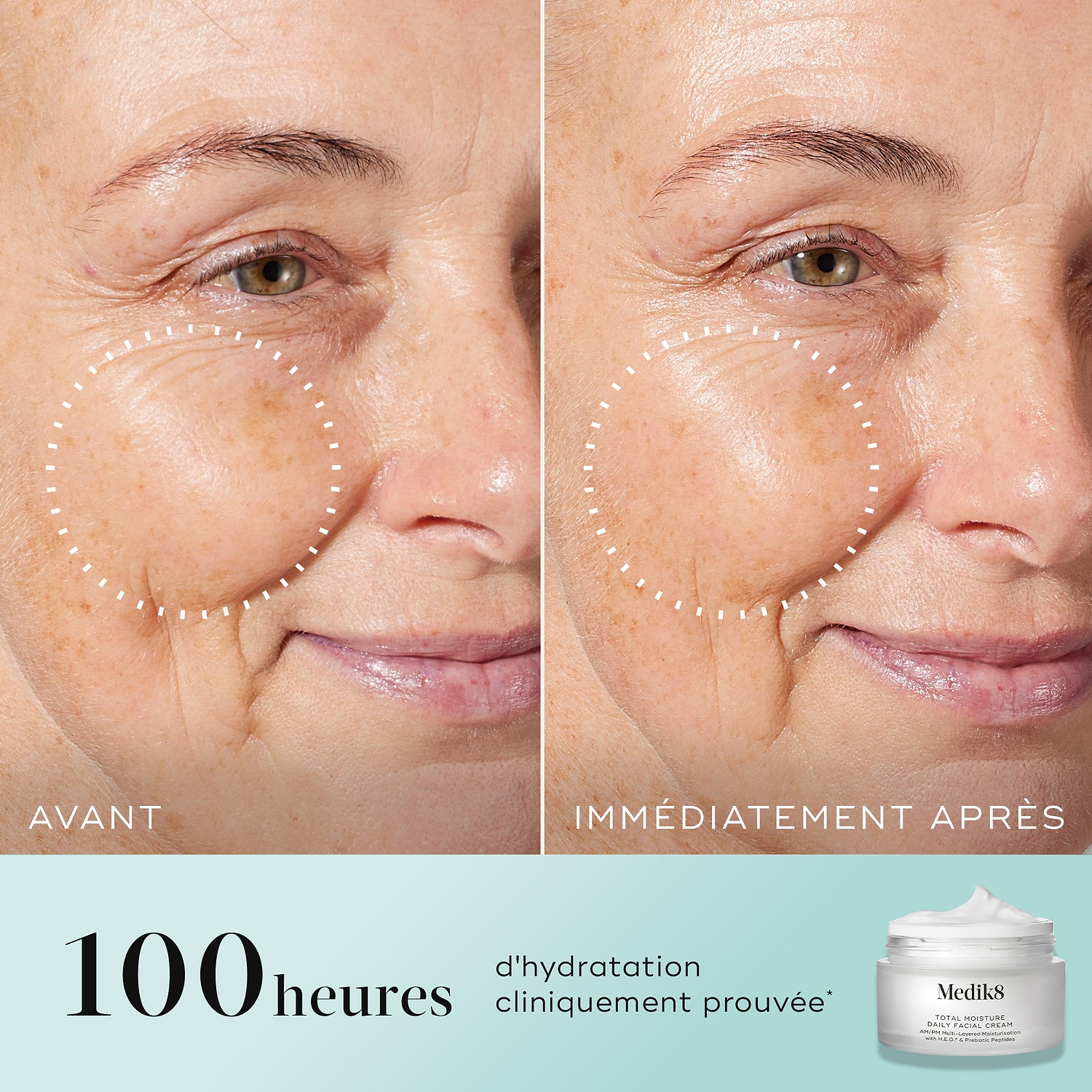 Comparaison en écran scindé avant-après de la joue et du contour des yeux d'une femme, avec un cercle pointillé soulignant la peau visiblement repulpée et les rides réduites sur la photo « IMMEDIATELY AFTER ». Le texte indique « 100 heures d'hydratation cliniquement prouvée* » à côté d'une image du pot Medik8 Total Moisture.