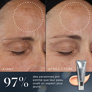 Comparaison avant et après d'un traitement cutané avec un tube de crème sur fond bleu.