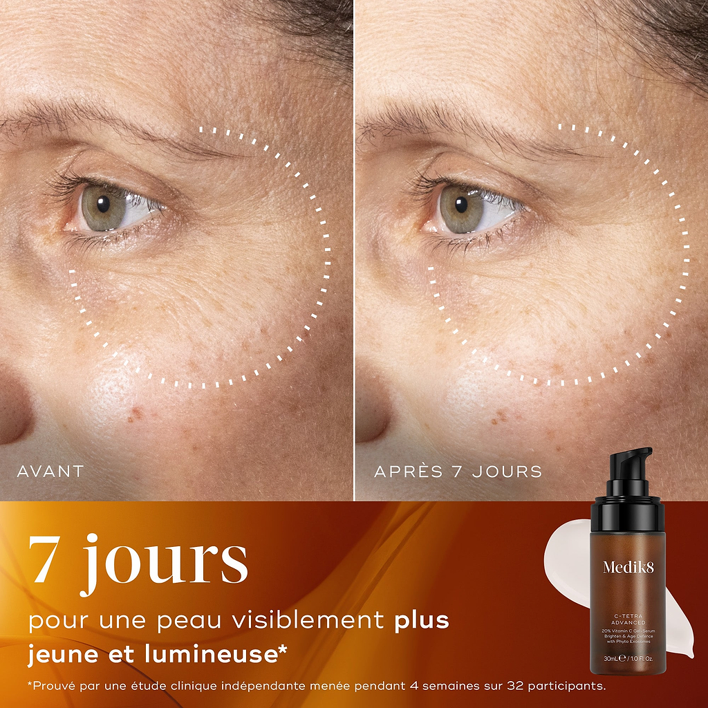 Comparaison avant/après de la peau d’un participant sur 7 jours, montrant une peau visiblement plus lumineuse avec un éclat et un teint uniformes améliorés.