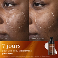 Gros plan avant/après de la peau d’un participant sur 7 jours, démontrant une texture de peau visiblement plus lisse et une apparence raffinée.