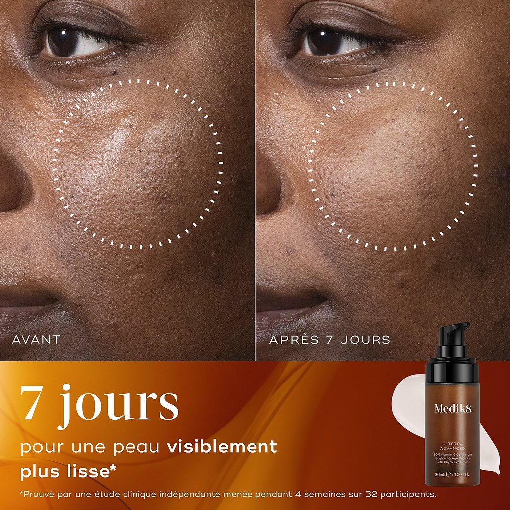 Gros plan avant/après de la peau d’un participant sur 7 jours, démontrant une texture de peau visiblement plus lisse et une apparence raffinée.
