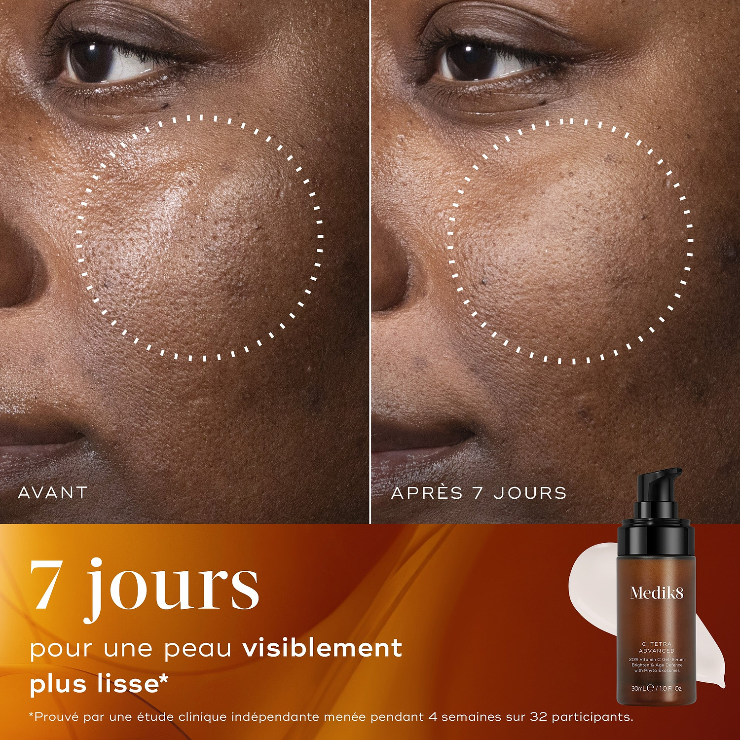 Gros plan avant/après de la peau d’un participant sur 7 jours, démontrant une texture de peau visiblement plus lisse et une apparence raffinée.