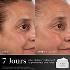 Comparaison avant-après du contour des yeux d'une participante sur 7 jours, présentée à côté du pot de crème Medik8 Advanced Pro-Collagen+ Peptide Cream. Le texte souligne que le produit réduit visiblement la profondeur des rides en 7 jours.