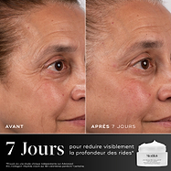 Comparaison avant-après du contour des yeux d'une participante sur 7 jours, présentée à côté du pot de crème Medik8 Advanced Pro-Collagen+ Peptide Cream. Le texte souligne que le produit réduit visiblement la profondeur des rides en 7 jours.